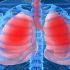 Campanha de sensibilização da Hipertensão Pulmonar