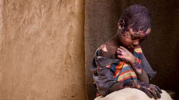 O Sudão está a ser palco de um terrível genocídio